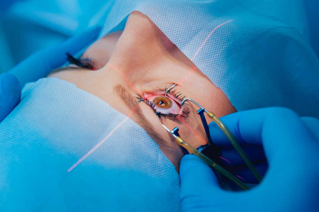 The fall and rise of refractive surgery eyeonoptics